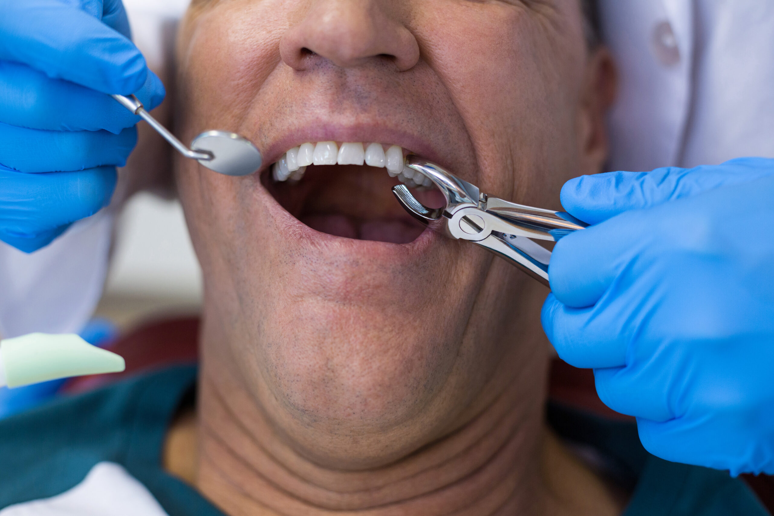 Your first tooth extraction — what to expect